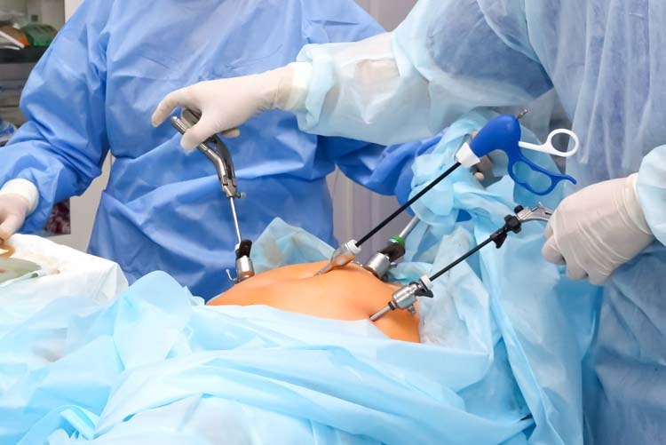Laparoscopic Procedures